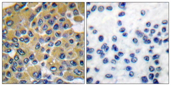 SH-PTP2 rabbit pAb Antibody