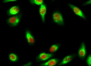 Skp2 p45 rabbit pAb Antibody