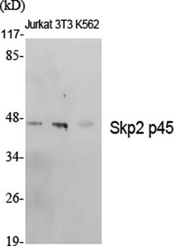 Skp2 p45 rabbit pAb Antibody