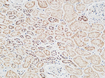 Skp2 p45 rabbit pAb Antibody