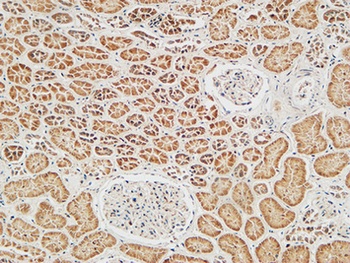 Skp2 p45 rabbit pAb Antibody