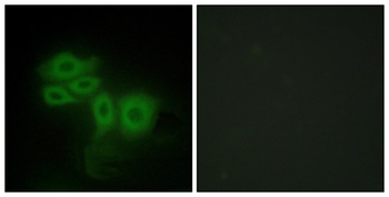 SLK rabbit pAb Antibody