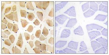 SLK rabbit pAb Antibody