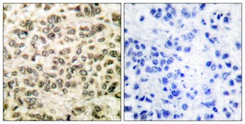 SMAP45 rabbit pAb Antibody