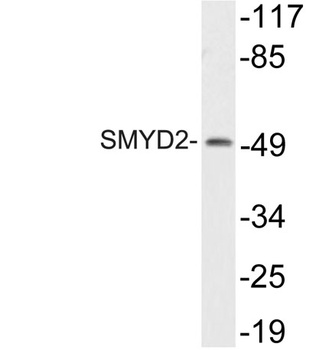 SMYD2 rabbit pAb Antibody