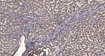 SMYD2 rabbit pAb Antibody