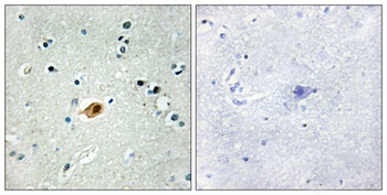 Sox-8/9/17/18 rabbit pAb Antibody