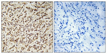 Spindlin-1 rabbit pAb Antibody