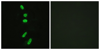 Splicing factor 1 rabbit pAb Antibody