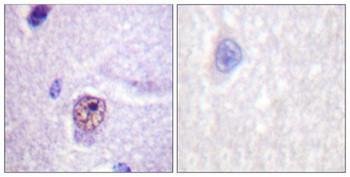 Splicing factor 1 rabbit pAb Antibody