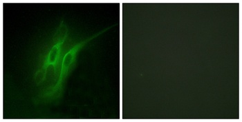 SR-4 rabbit pAb Antibody