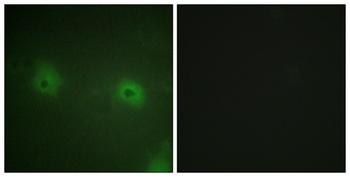 STAM2 rabbit pAb Antibody