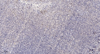 STAM2 rabbit pAb Antibody