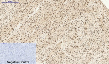Stat1 rabbit pAb Antibody