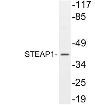 STEAP1 rabbit pAb Antibody