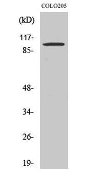Synphilin-1 rabbit pAb Antibody