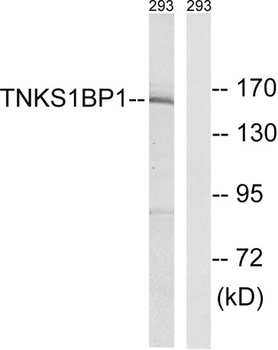 TAB182 rabbit pAb Antibody