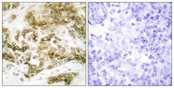 TBX15/18 rabbit pAb Antibody