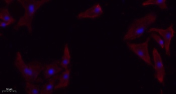 TGFβ RI rabbit pAb Antibody