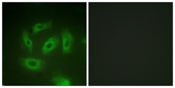 TGFβ RI rabbit pAb Antibody