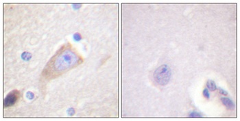 Tyrosine Hydroxylase rabbit pAb Antibody