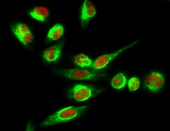 Tyrosine Hydroxylase rabbit pAb Antibody
