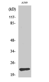 TIMP-2 rabbit pAb Antibody