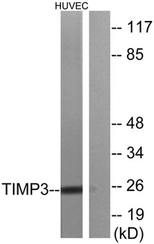 TIMP-3 rabbit pAb Antibody