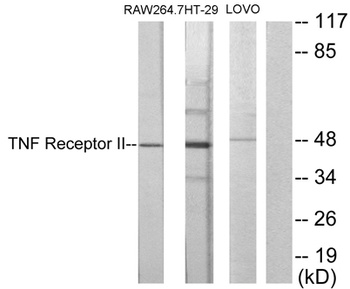 TNF-R2 rabbit pAb Antibody