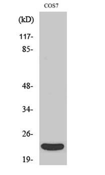 TNF-β rabbit pAb Antibody