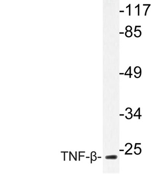 TNF-β rabbit pAb Antibody