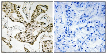 Topo IIα rabbit pAb Antibody