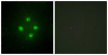 TRAP100 rabbit pAb Antibody