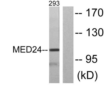 TRAP100 rabbit pAb Antibody
