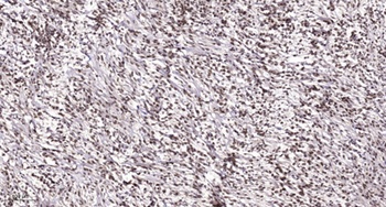 TRAP100 rabbit pAb Antibody