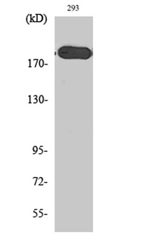 Tuberin rabbit pAb Antibody