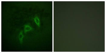 Tuberin rabbit pAb Antibody