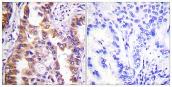 Tuberin rabbit pAb Antibody