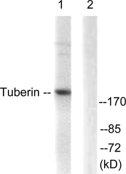 Tuberin rabbit pAb Antibody