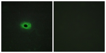 TWEAK rabbit pAb Antibody