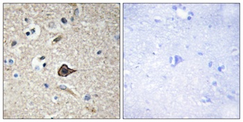 TWEAK rabbit pAb Antibody