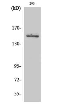 Tyk 2 rabbit pAb Antibody