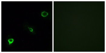 Tyk 2 rabbit pAb Antibody