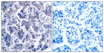 Tyk 2 rabbit pAb Antibody