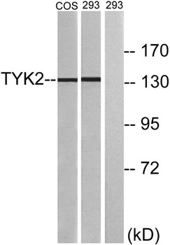 Tyk 2 rabbit pAb Antibody
