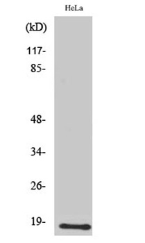 UBE2D2 rabbit pAb Antibody
