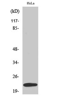 UBE2T rabbit pAb Antibody