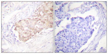 UBR5 rabbit pAb Antibody