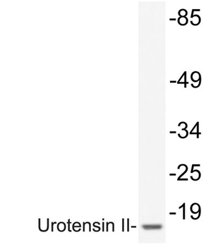 Urotensin II rabbit pAb Antibody