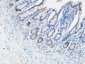 VDR rabbit pAb Antibody
